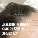 (주)코리아세븐 서초방배점 | 서초방배 두피문신 SMP의 모든것,자신감 UP