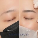 뷰티로은 | 덕천동 눈썹 문신 잘하는 곳 찾다 결국 미남역 라온뷰티로 정착한 리얼 후기 출처 : BROW SMP SKIN