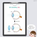 안경백서 이미지