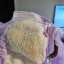 (주)아워홈 평택성모병원 | 5개월아기 기관지염 rsv바이러스 평택 소아과 성모아이들의원 입원기