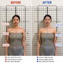 쏘영화장품 | 목동 피부관리 쏘영피부연구소｜얼굴·몸 비대칭 관리 직접 받아본 후기