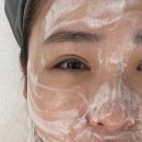 인천 부평 피부관리 잘하는곳 노아르에스테틱 민감성 여드름피부