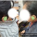 오티콘보청기도봉점 이미지