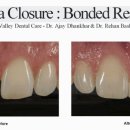 바닐라치과의원 이미지