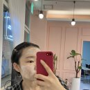 인천피부관리 인천인셀덤, 송도인셀덤 퍼스트패키지 송도점 체험후기