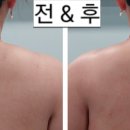 바른선 테라피