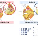 고관절, 무릎 관절 명의 웰튼병원 송상호 병원장 이미지