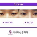 에스라인 이미지