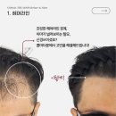 콤마더문 이미지