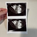 겔배하우스 | [임신 32주~36주] 셀프만삭촬영/막달검사/산후도우미신청/태교호캉스/출산가방싸기/모빌만들기