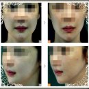 비포성형외과의원 이미지