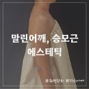 힐링미한의원 | [마곡에스테틱] 승모근 순삭, 직각어깨 만들어주는 오브미에스테틱