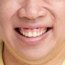 스마일분당예치과병원 이미지