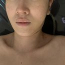 행복캐슬 102동 | 송도에스테틱 작은얼굴관리 윤곽관리 잘하는곳 매력공간 후기