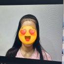 1 | 모발이식 리얼후기 (1년 경과)