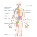 백혈병[혈액과 골수에 영향을 미치는 암] 이미지