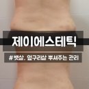 구미문성초등학교 | [구미 테라노바] 제이에스테틱 지독한 뱃살 때문에 찾은 체형관리샵 관리 후기