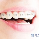 연세필치과교정과 이미지