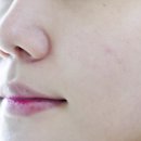 뷰온(BEUON) | 뷰온 톡스틱 나의 트러블케어 도와줘