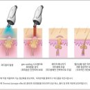 진성레이져 이미지