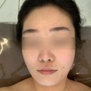 양산피부관리 라라뷰티제이 손에 꼽는 윤곽관리 후기