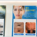 브로우제이 이미지