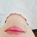 [두정동 피부관리] 미작뷰티 천안점에서 기미·잡티·미백관리받고 왔어요!