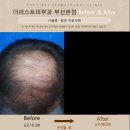 화명하나병원 네이버블로그