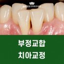 글로리아치과교정과치과의원 네이버블로그
