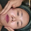 대구달서구피부관리 &#39;킴그린스킨앤바디&#39; 물광테라피케어 후기!