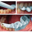 안면고등학교 | [보철] 총의치 악간관계1 (교합채득, 수직고경, 교합고경, 중심위)