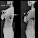 물리치료사의 바디포스쳐 PT 이미지