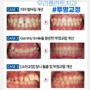 명인플란트치과의원 이미지