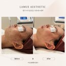 민성 메디칼 | 아크네 관리 후기