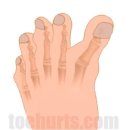 무지내동 태봉 이미지