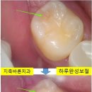 더바른 치과기공소 네이버블로그
