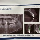좋은하루1차 | 수원 임플란트 잘하는 치과에서 개최한 2차 치아 건강 세미나 다녀왔어요 :)