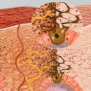 미주메디칼 | "홍조"에서부터 시작하는 모공과 기미치료