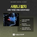 섬세한사랑니치과의원 이미지