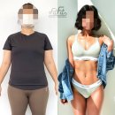 증산-004 | [공지] 양산피티 추천, 비포애프터만 3000개 결과로 증명한다
