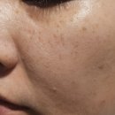 메디포엘 이미지