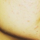 내포정성한의원 | 수원시피부과질환 단조롭지 않기에