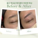 울산왁싱샵 삼산동 제이콤마왁싱 눈썹왁싱 잘하는곳