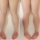 사평빌딩 앞 | 반포] 선에스테스파 서초본점반포피부관리 반포에스테틱 선에스테스파 서초본점에서 슬리밍 바디 관리후기