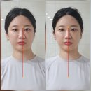 구암로49길 | 대구칠곡피부관리 작은얼굴바른몸매 두골비·두골체 관리 솔직 후기