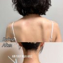 하이힐 | 승모근 하이힐주사 내돈내산 후기｜청담피부과, 이걸 왜 이제야 했나