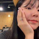 미드림치과의원 | 수원에서 점 뺐어요 개아파서 소리지름,, 나,, 생긴대로 살래,,