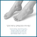 김포 발등통증 이유는? 재활의학과 에서 이미지