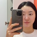 행정타운로 | 경기광주에스테틱 [루미에스떼] 금손원장님 써마웨이브로 브이라인 되찾은 후기