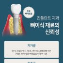 상록수치과기공소 이미지